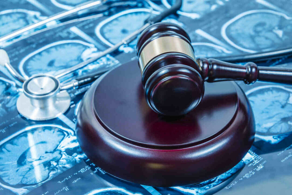 San Jose Brain Injury Lawyer