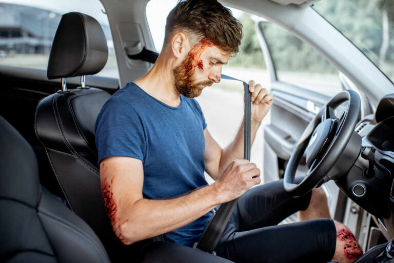 Internal Bleeding several car crash