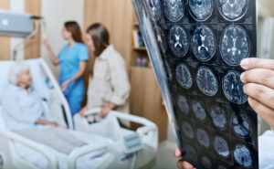 Brain Injury Symptoms Before Medical Providers